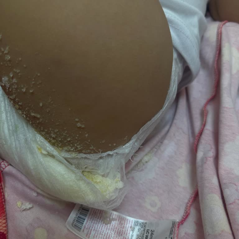 Küçük Bir Çişte Bile Sızdıran Bebek Beziyle Yaşadığım Sorun