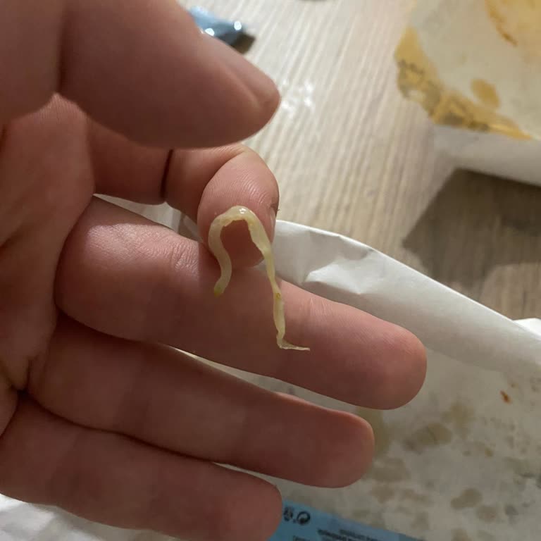 Maydonoz Döner Şubesinde Pişmemiş Tavuk Ve Kaba Davranış