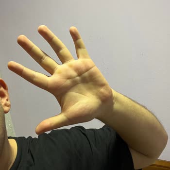 Ayıplı İphone 13 İçin Yetersiz Teknik Servis Ve Çözüm Eksikliği