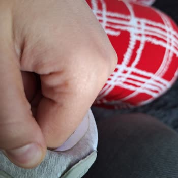 58 Günde Açılan Adidas Ayakkabı ve Garanti Hayal Kırıklığı