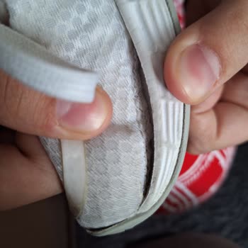 58 Günde Açılan Adidas Ayakkabı ve Garanti Hayal Kırıklığı