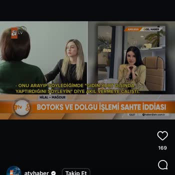 Sahte Doktor Yüzümde Kalıcı Hasar Bıraktı Tedavi Masraflarım Karşılanmadı