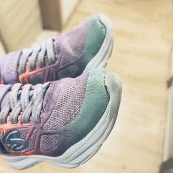 Skechers Kısa Sürede Yırtılan Ayakkabı ve Firma İlgisizliği