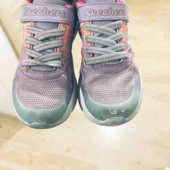Skechers Kısa Sürede Yırtılan Ayakkabı ve Firma İlgisizliği