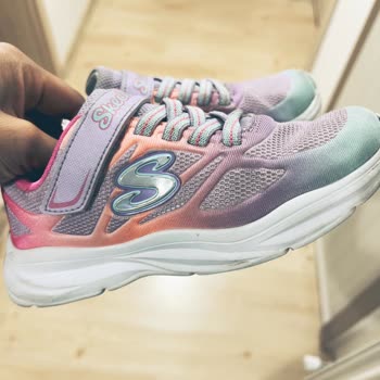 Skechers Kısa Sürede Yırtılan Ayakkabı ve Firma İlgisizliği