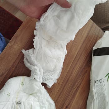 Aldığım Bebek Bezlerinde Yırtılma Ve Bant Sorunu
