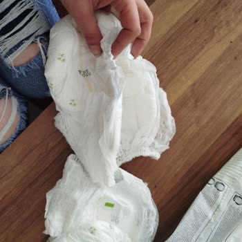 Aldığım Bebek Bezlerinde Yırtılma Ve Bant Sorunu