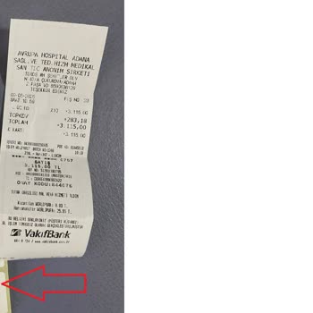 Özel Sağlık Sigortam Olmasına Rağmen Yanlış İşlem Ve Ücret Alındı