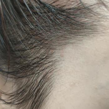 Ceel Şampuan Ve Yağı Saç Dökülmesi Ve Deri Sorunlarına Yol Açtı