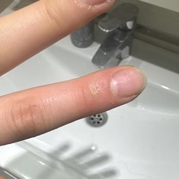 Simfer Mini Retro Fırın Değişim Sürecinde Mağduriyet Ve İletişim Sorunları