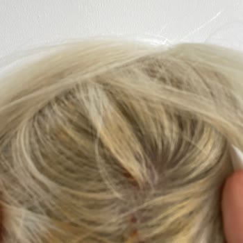 Saç Boyası Kullanımında Şiddetli Yanma Ve Deri Sorunları