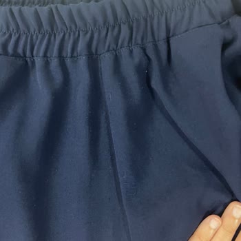 Satın Aldığım Takımda İlk Giyimde Tüylenme Ve Firma İlgisizliği