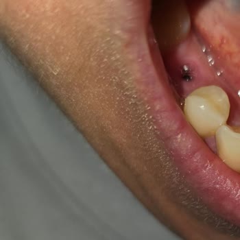 Gebze Çapa Diş Kliniği'nin İşçiliklerinden Ve Tavırlarından Memnun Kalmadık