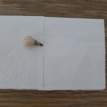 Gebze Çapa Diş Kliniği'nin İşçiliklerinden Ve Tavırlarından Memnun Kalmadık