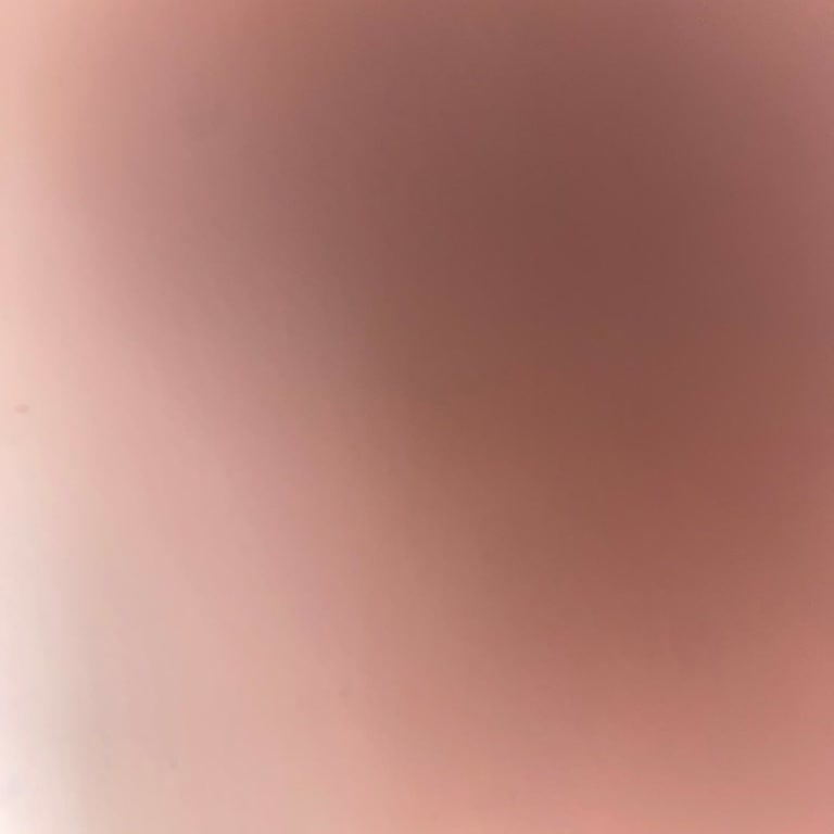 Acıbadem Genel Merkezde Yetersiz Gişe Ve Uzun Bekleme Süresi