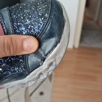 Skechers mangelhafte Qualität bei Kinderschuhen, keine Lösung!
