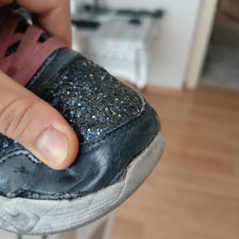 Skechers mangelhafte Qualität bei Kinderschuhen, keine Lösung!