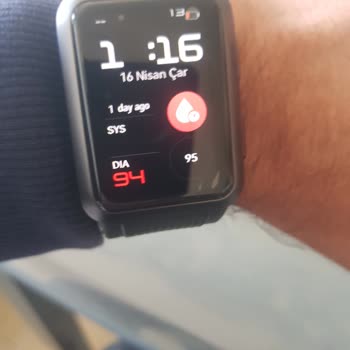Huawei Servisinden Yetersiz Destek Ve Çözümsüzlük