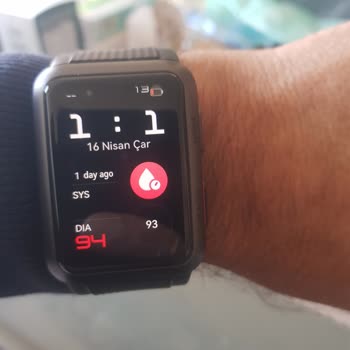 Huawei Servisinden Yetersiz Destek Ve Çözümsüzlük