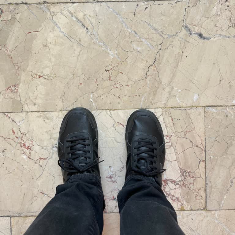 Skechers Ayakkabıda Kısa Sürede Yamulma Sorunu