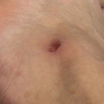 Kusurlu Ayakkabı Nedeniyle İade Talebimin Mağaza Tarafından Reddi