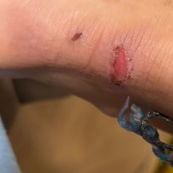 Kusurlu Ayakkabı Nedeniyle İade Talebimin Mağaza Tarafından Reddi