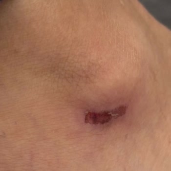 Kusurlu Ayakkabı Nedeniyle İade Talebimin Mağaza Tarafından Reddi