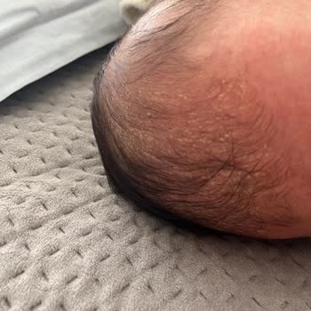 Mustela Konak-Shampoo hat Hautprobleme bei meinem Baby verursacht, Rötungen und Irritationen