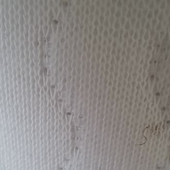Lekeli Yatak Teslimatı Ve Değişim Sürecinde Yaşanan Gecikme