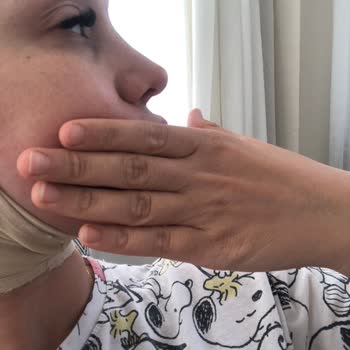 İkinci Burun Ameliyatı Sonrası Memnuniyetsizlik Ve Yetersiz Destek