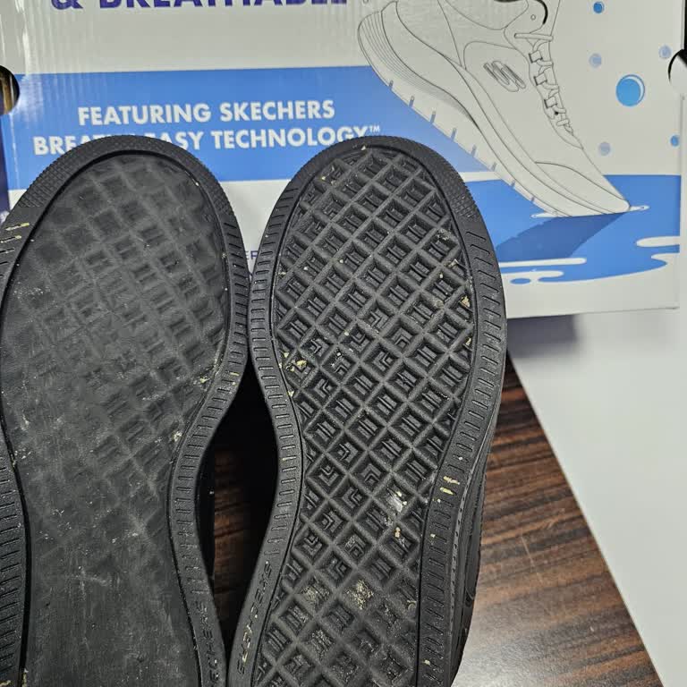 Skechers Ayakkabıda Taban Sorunu Ve Kullanıcı Hatası İddiası