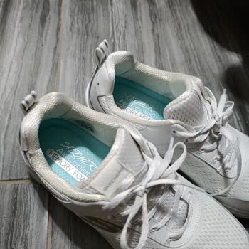 Skechers Ayakkabı Topukta Ağrı Ve Yara Yaptı