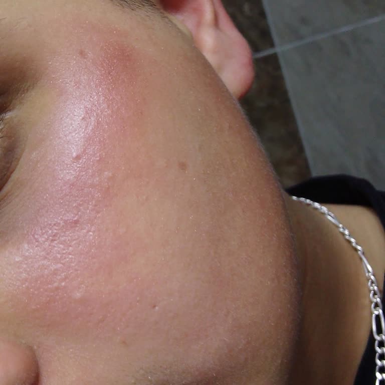 Neutrogena Peeling Jel Yüzümde Şiddetli Tahrişe Sebep Oldu