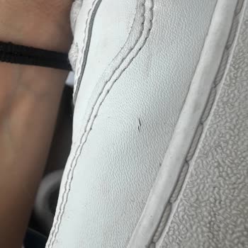 Lacoste Kısa Sürede Derisi Kırılan Ayakkabı Ve İlgisiz Müşteri Hizmeti!