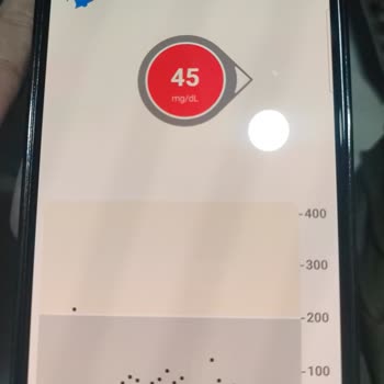 Dexcom 6 Cihazında Sürekli Yanlış Ölçüm Ve Yetersiz Destek
