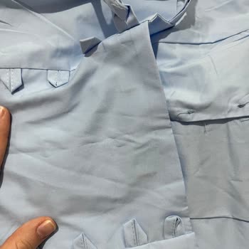 Kumaşı Beklentimi Karşılamayan Elbise Ve Haksız Kesinti