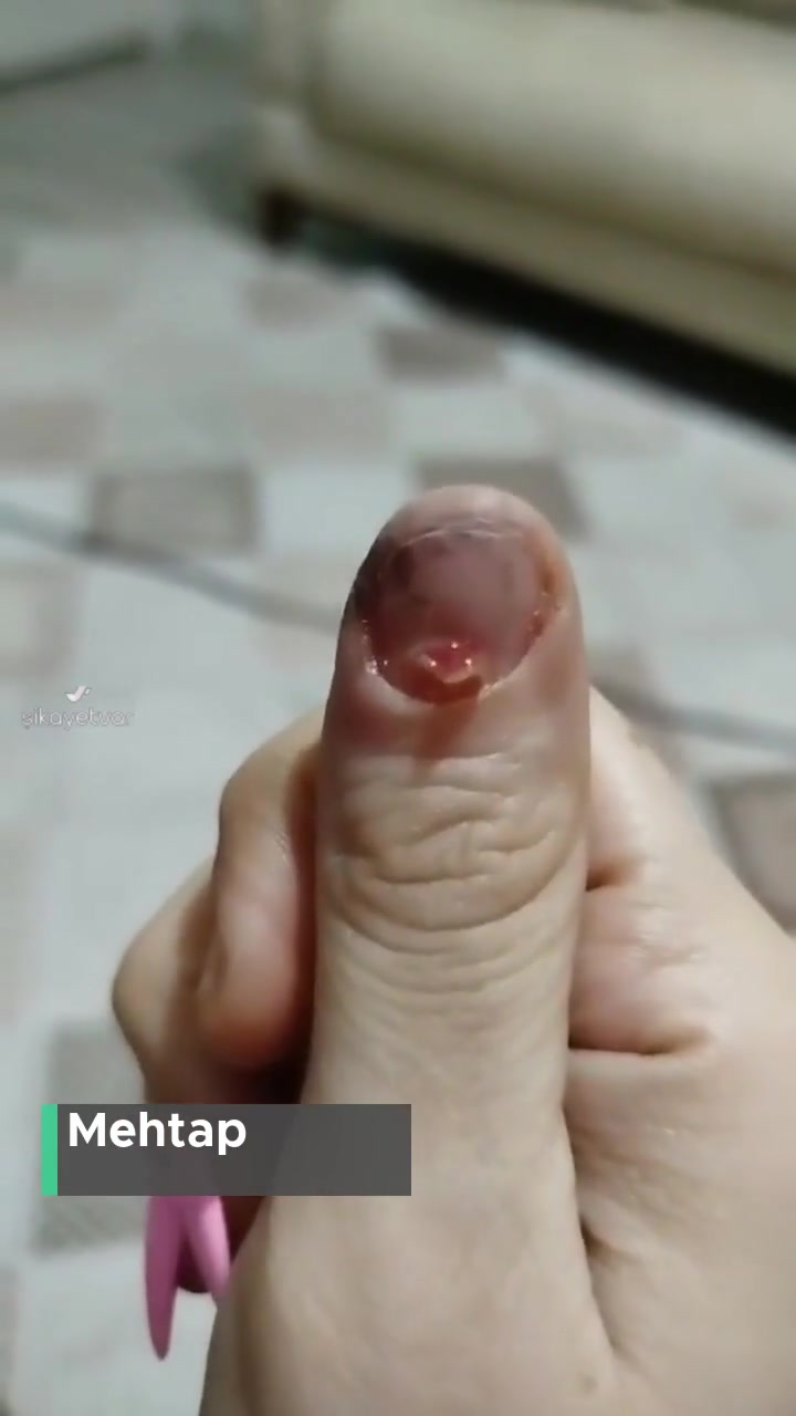 Serap Doğan Güzellik Merkezi İşini Doğru Yapmayan Güzellik Merkezi! videonun kapak resmi