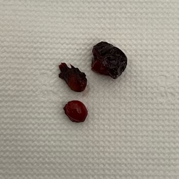 Kahvaltıda Beklenmedik Çekirdek Küçük Çocuğumun Dişi Kırıldı