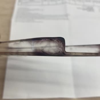 Apple MagSafe Kılıf Karardı, Garanti Çözüm Sunmadı Pişman Olduk