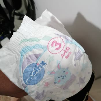 Molfix 3 Numara Bebek Bezinde Kalite Ve Sızdırma Sorunu