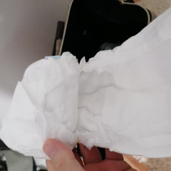 Molfix 3 Numara Bebek Bezinde Kalite Ve Sızdırma Sorunu