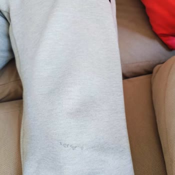 Adidas Eşofman Altında Hızlı Aşınma Ve Yetersiz Müşteri Hizmeti