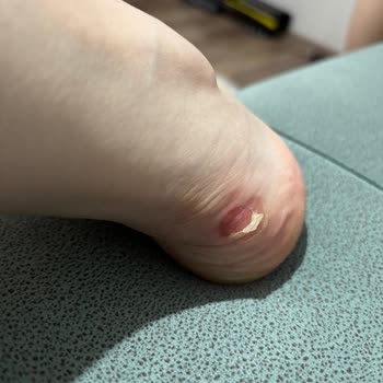 Outletten Alınan Ayakkabıda İade Ve Değişim Sorunu