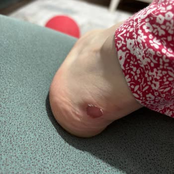 Outletten Alınan Ayakkabıda İade Ve Değişim Sorunu