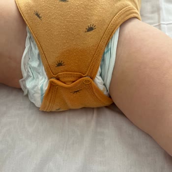 Prima Bebek Bezi Sızdırma Sorunu Ve Çözüm Beklentisi