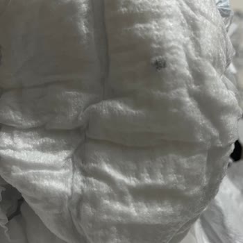 Molfix Bebek Bezinden Çıkan Yabancı Cisim Ve Müşteri Hizmetleri İlgisizliği