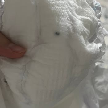 Molfix Bebek Bezinden Çıkan Yabancı Cisim Ve Müşteri Hizmetleri İlgisizliği