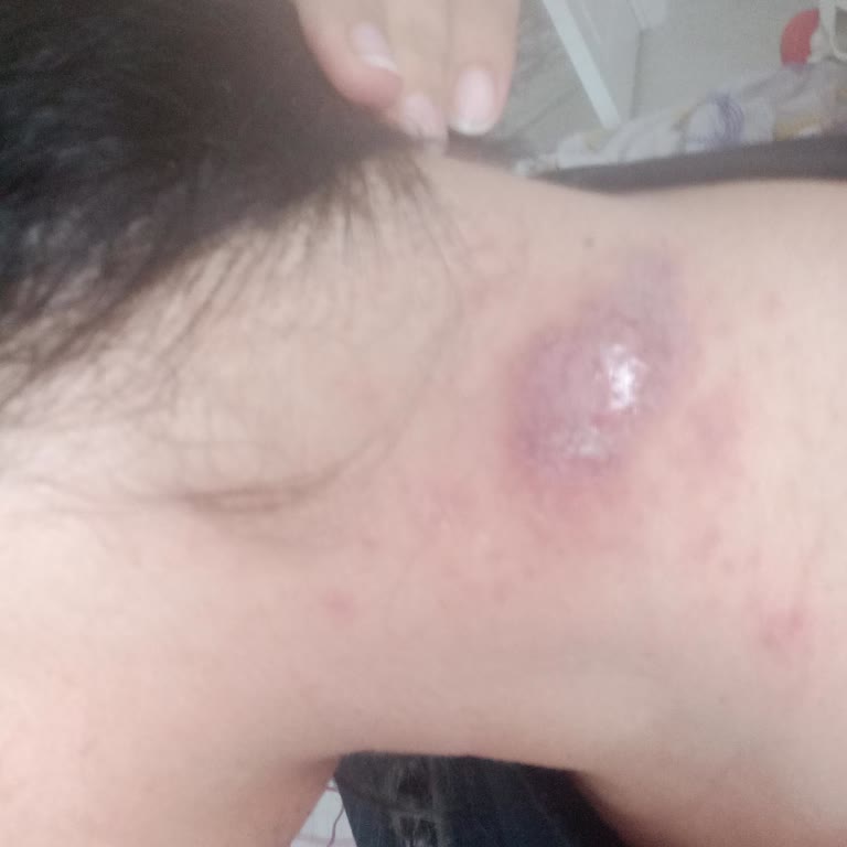 Saç Boyası Sonrası Yaşadığım Ciddi Sağlık Sorunu