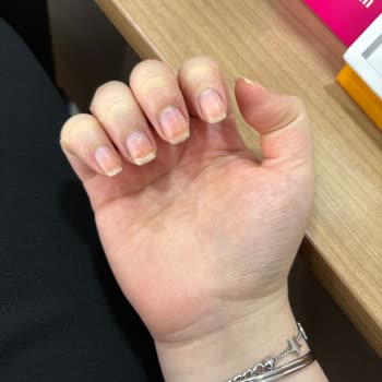 Flormar Yeşil Oje Tırnaklarımı Sararttı, Sağlığını Bozdu