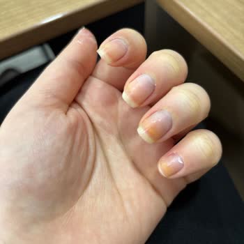 Flormar Yeşil Oje Tırnaklarımı Sararttı, Sağlığını Bozdu